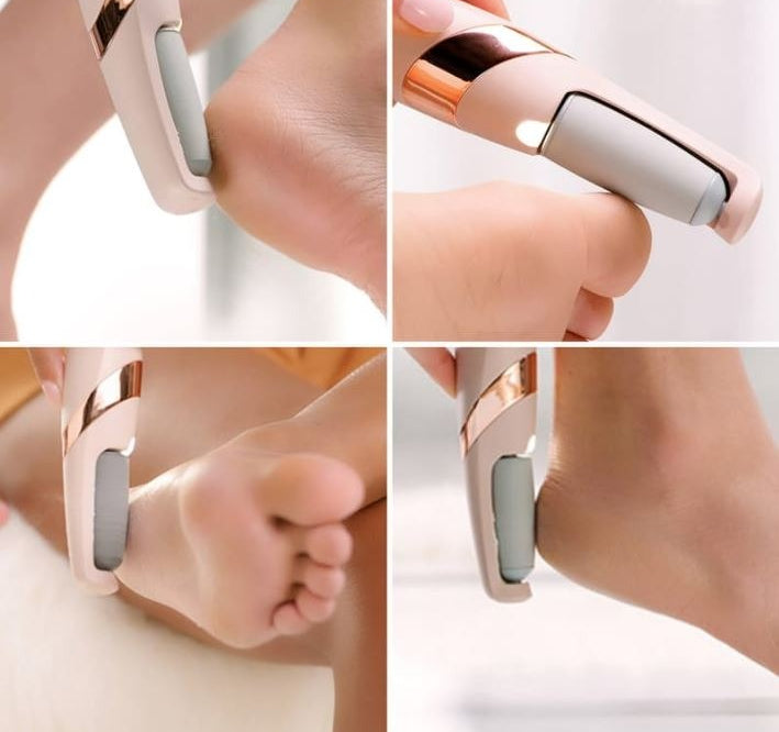 Rechargeable Electric Pedi Foot Filer – Callus & Dead Skin Remover