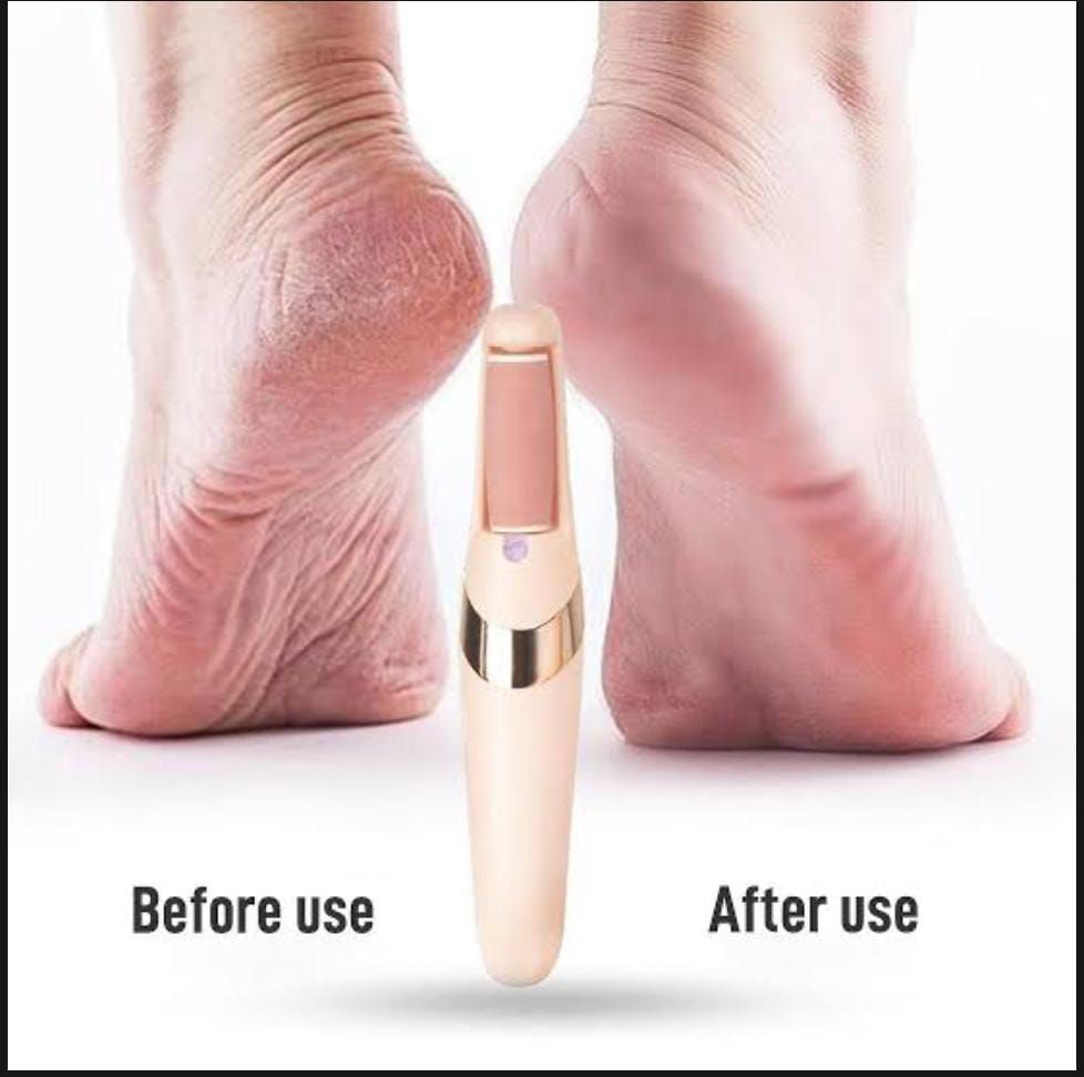 Rechargeable Electric Pedi Foot Filer – Callus & Dead Skin Remover